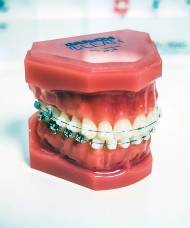zdjęcie sztucznych zębów