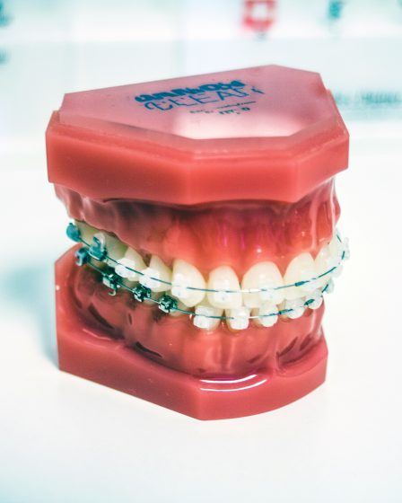 zdjęcie sztucznych zębów