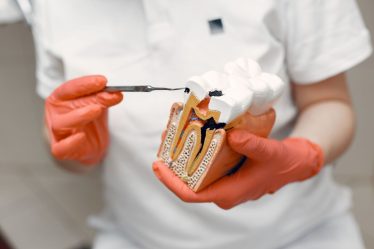 dentystka trzymająca model zniszczonego zęba