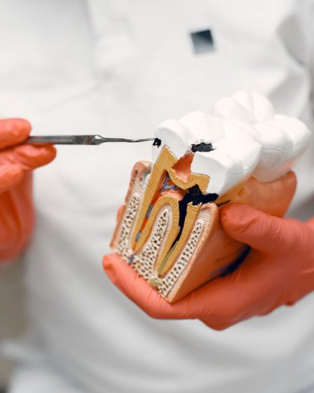 dentystka trzymająca model zniszczonego zęba